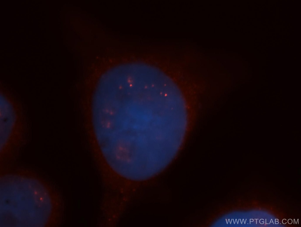 IF Staining of HeLa using 12363-1-AP