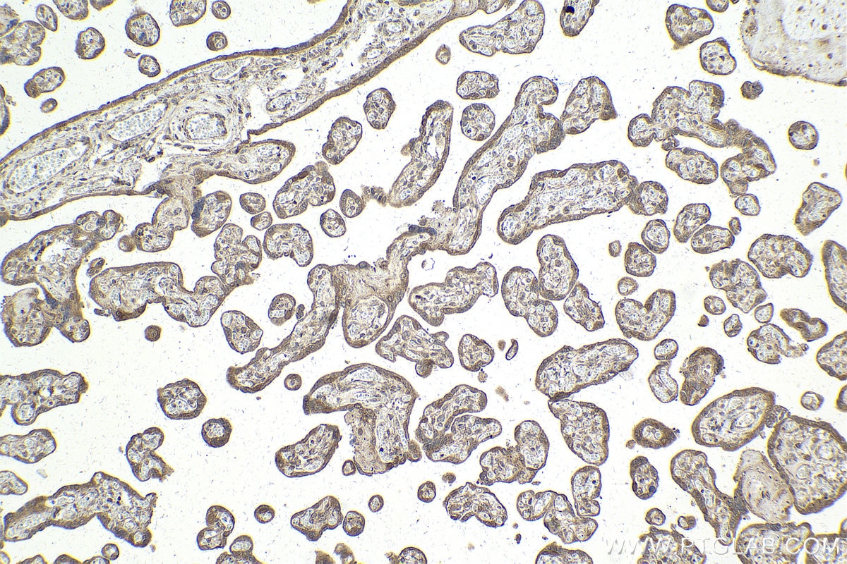 IHC staining of human placenta using 12363-1-AP Immunohistochemistry (IHC) staining of human placenta tissue using CCNDBP1 Polyclonal antibody (12363-1-AP)