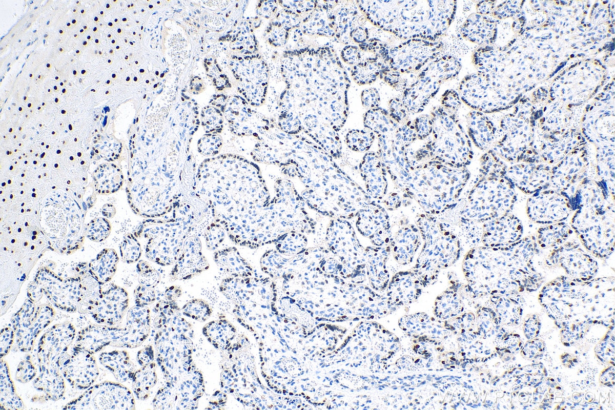 Immunohistochemistry (IHC) staining of human placenta tissue using Cyclin E1 Polyclonal antibody (11554-1-AP)