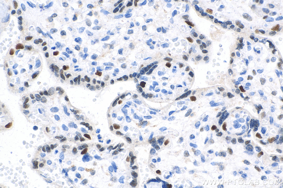 Immunohistochemistry (IHC) staining of human placenta tissue using Cyclin E1 Polyclonal antibody (11554-1-AP)