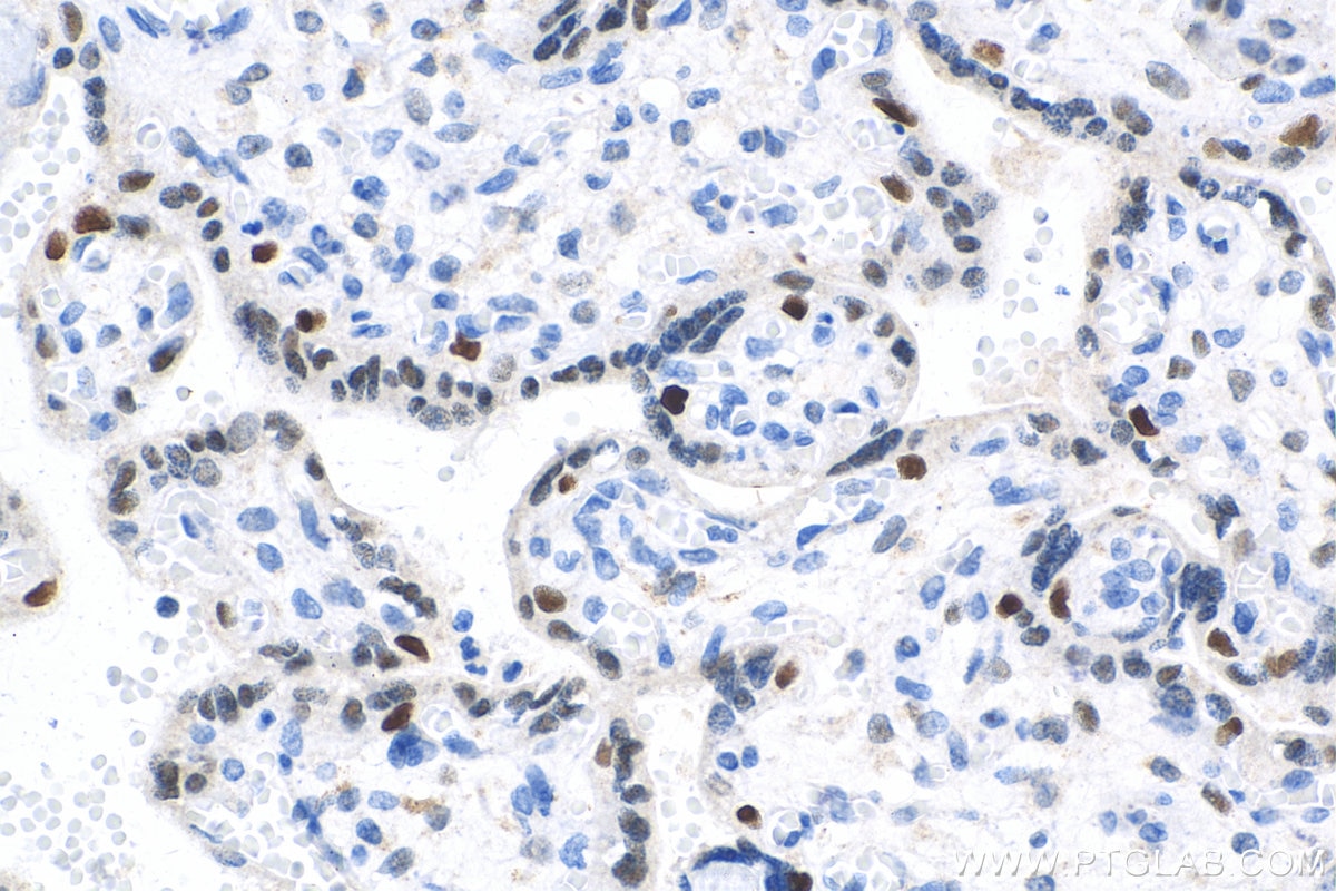 IHC staining of human placenta using 11554-1-AP