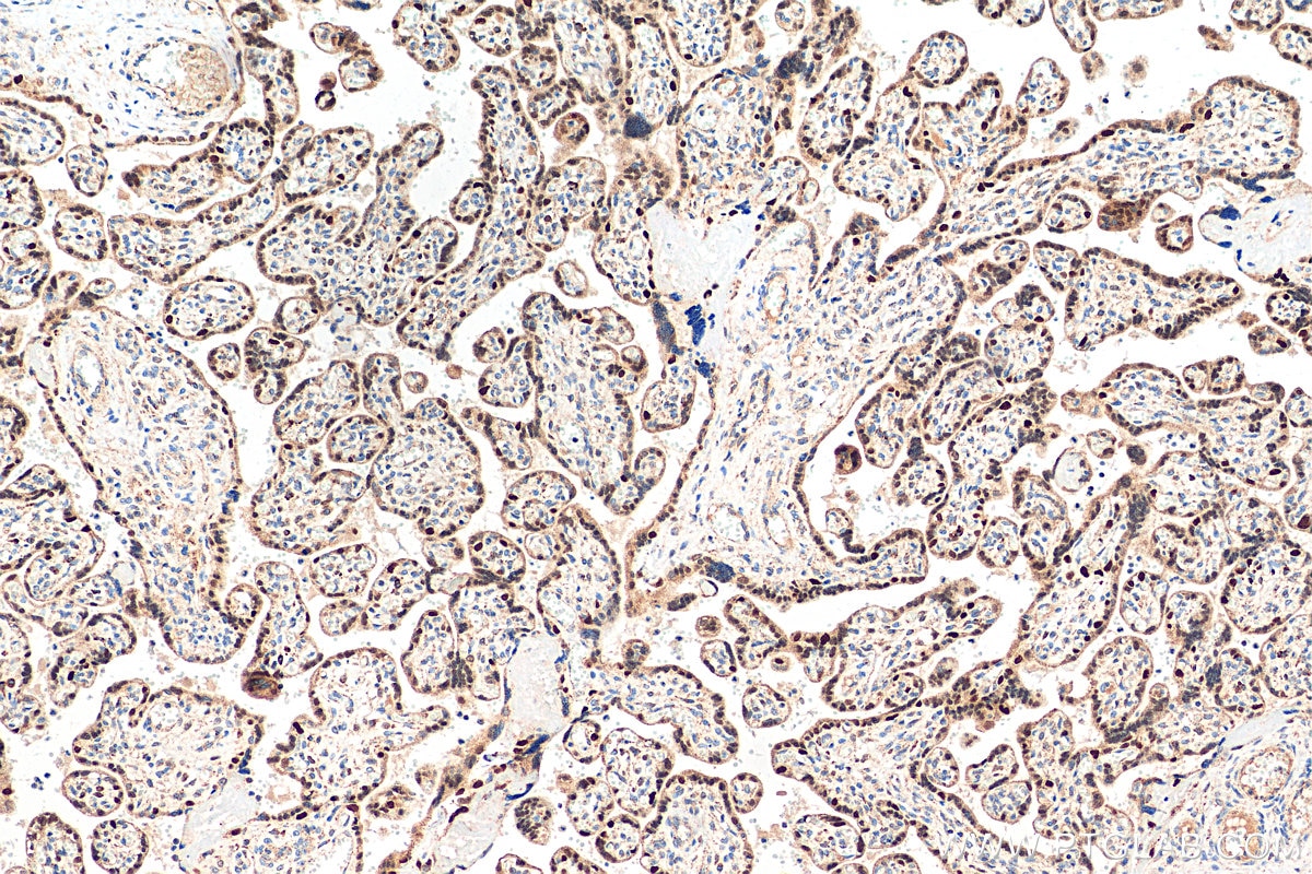 Immunohistochemistry (IHC) staining of human placenta tissue using Cyclin E1 Polyclonal antibody (11554-1-AP)