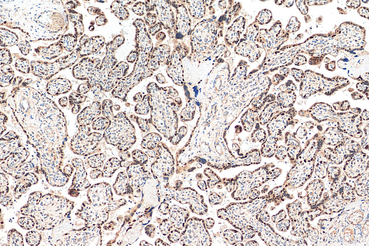 IHC staining of human placenta using 11554-1-AP