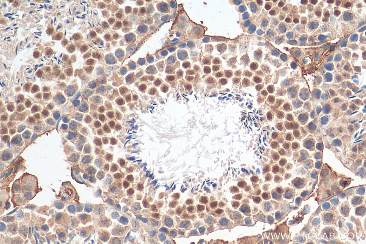 Immunohistochemistry (IHC) staining of mouse testis tissue using Cyclin E1 Polyclonal antibody (11554-1-AP)
