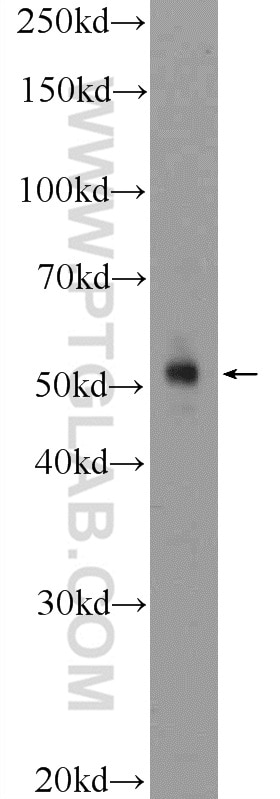 Cyclin E1 Polyclonal antibody