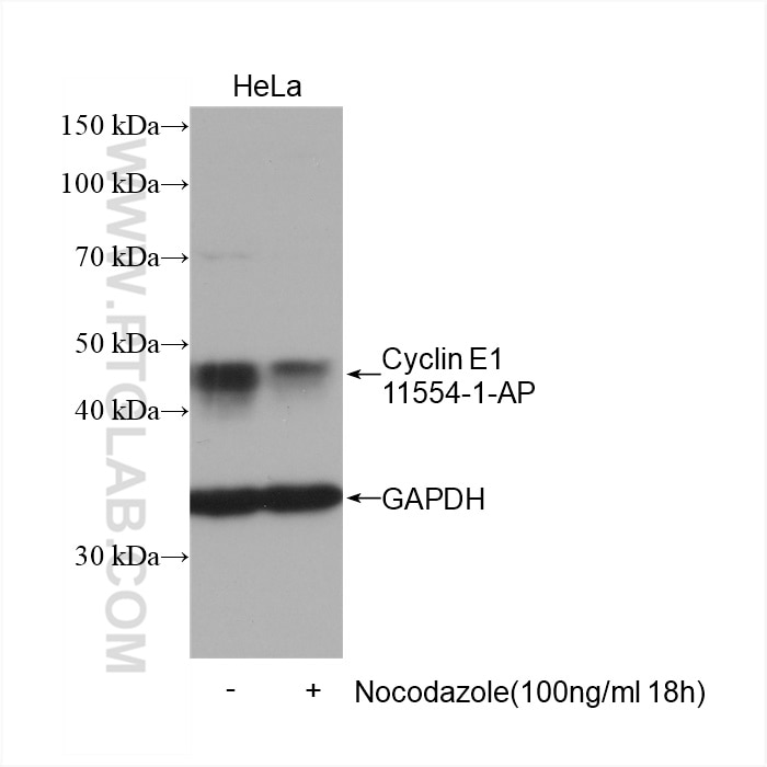 Western Blot (WB) analysis of HeLa cells using Cyclin E1 Polyclonal antibody (11554-1-AP)
