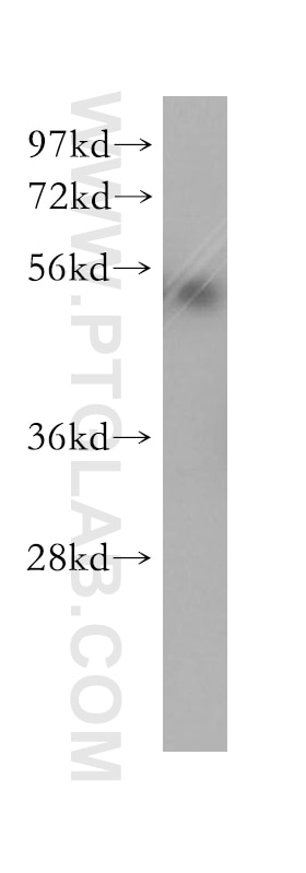 Western Blot (WB) analysis of HeLa cells using Cyclin E1 Polyclonal antibody (11554-1-AP)