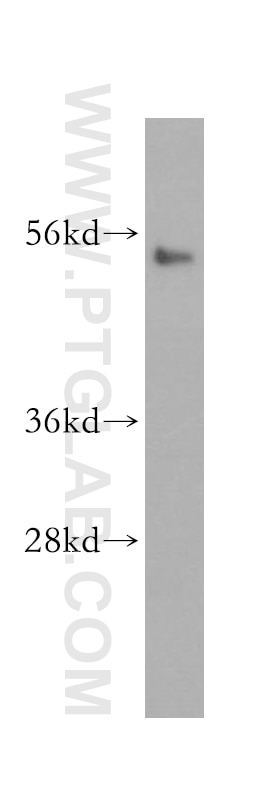 Western Blot (WB) analysis of Jurkat cells using Cyclin E1 Polyclonal antibody (11554-1-AP)