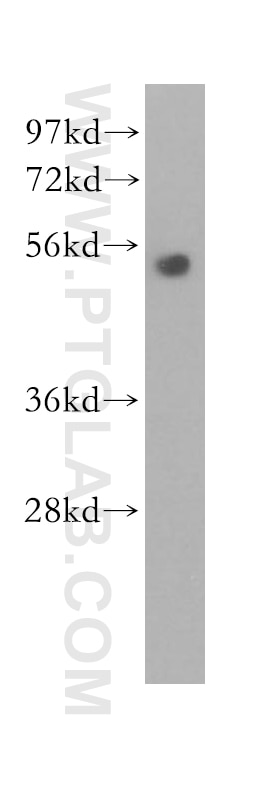 Western Blot (WB) analysis of human lung tissue using Cyclin E1 Polyclonal antibody (11554-1-AP)