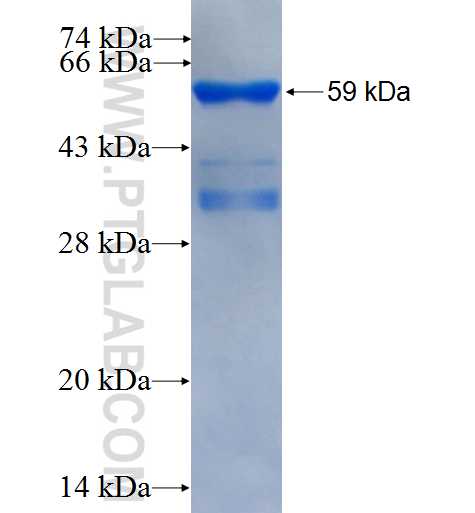 Cyclin E fusion protein Ag2110 SDS-PAGE