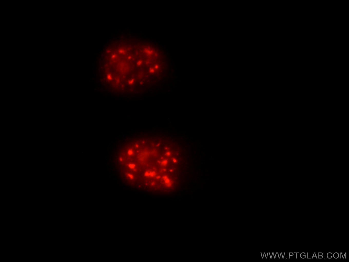 Immunofluorescence (IF) / fluorescent staining of HeLa cells using Cyclin E2 Polyclonal antibody (11935-1-AP)