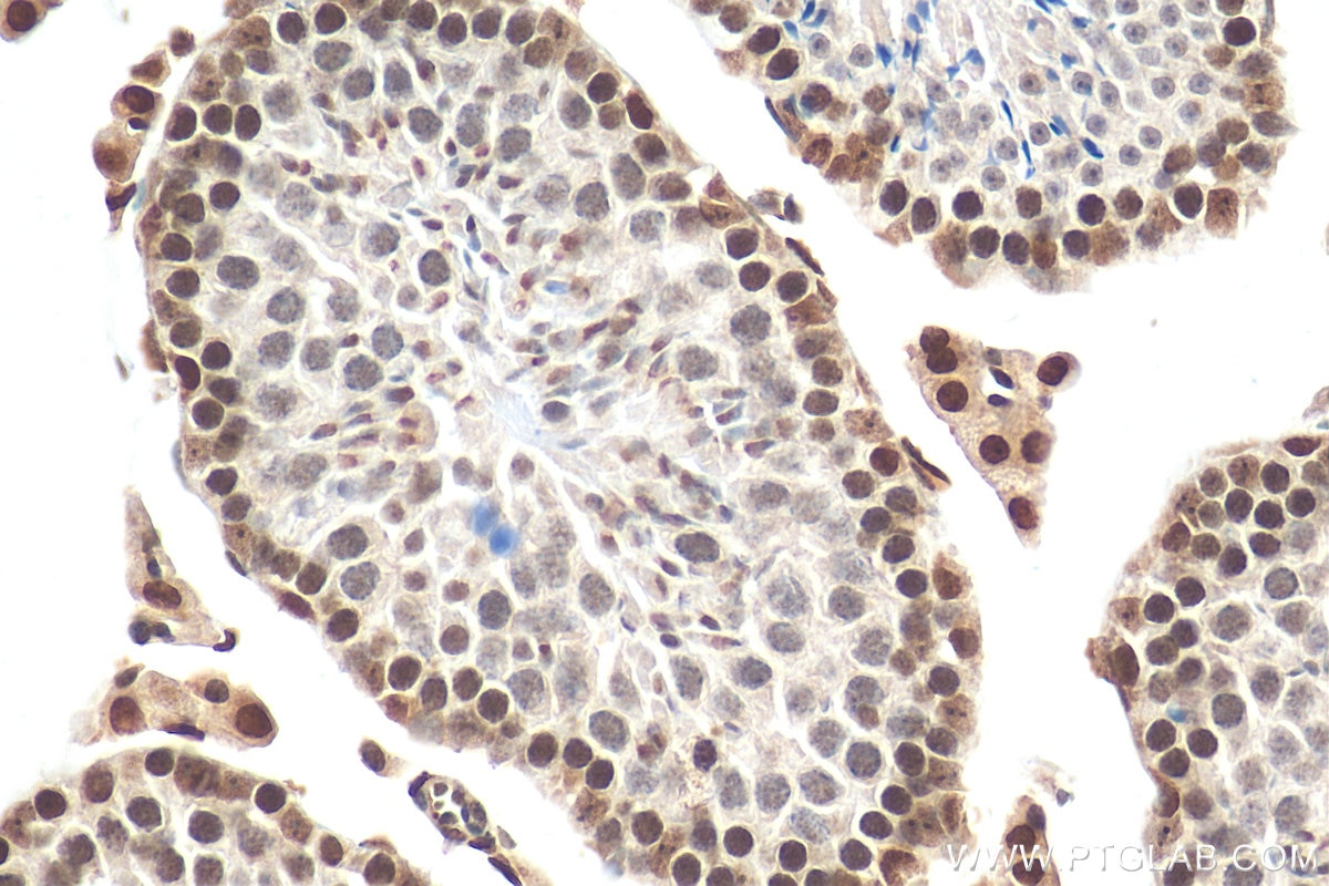 Immunohistochemistry (IHC) staining of mouse testis tissue using Cyclin E2 Polyclonal antibody (11935-1-AP)