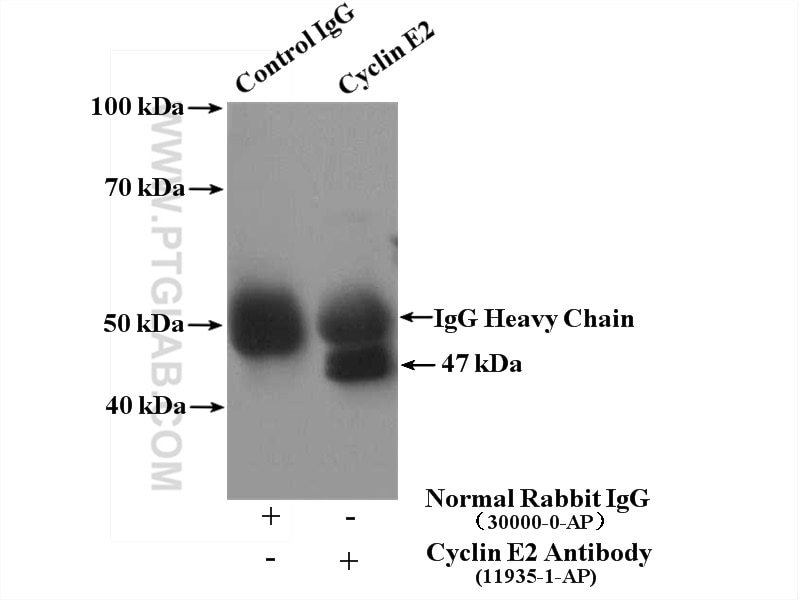 Immunoprecipitation (IP) experiment of Jurkat cells using Cyclin E2 Polyclonal antibody (11935-1-AP)