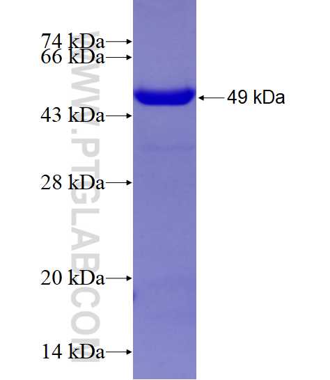 CCNE2 fusion protein Ag23601 SDS-PAGE