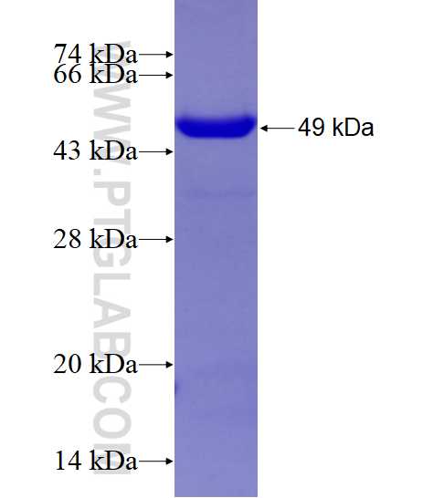 CCNE2 fusion protein Ag23601 SDS-PAGE