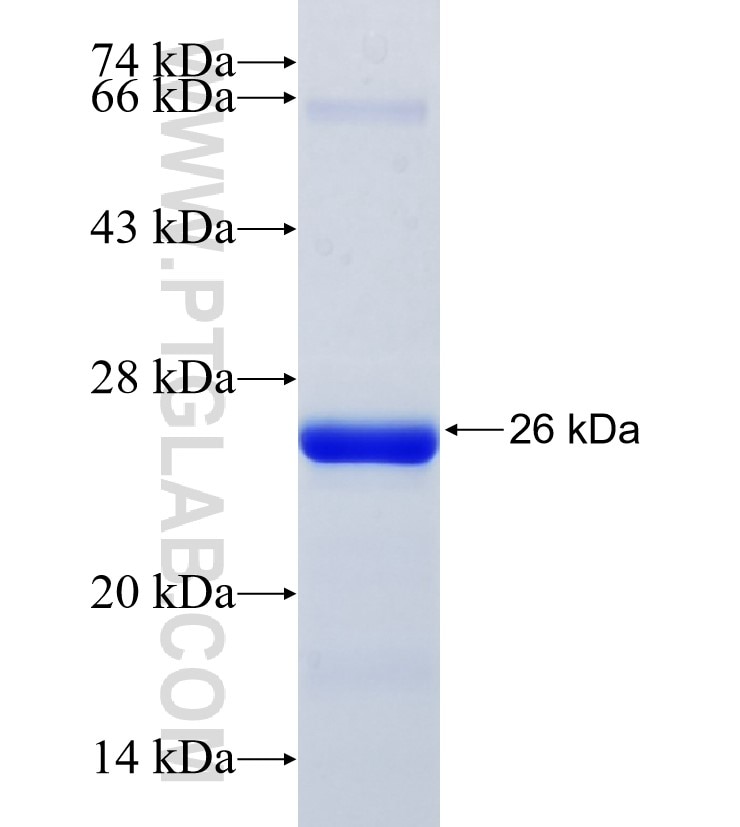 CCNE2 fusion protein Ag26037 SDS-PAGE