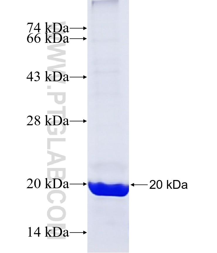 CCNE2 fusion protein Ag29625 SDS-PAGE