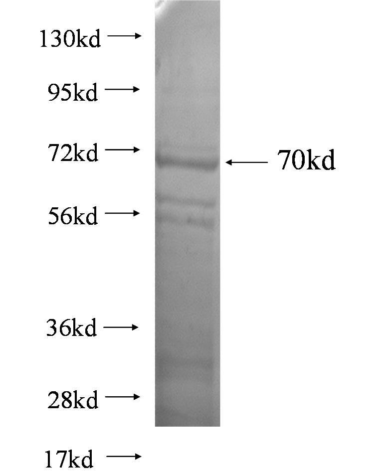 CCNE2 fusion protein Ag0902 SDS-PAGE