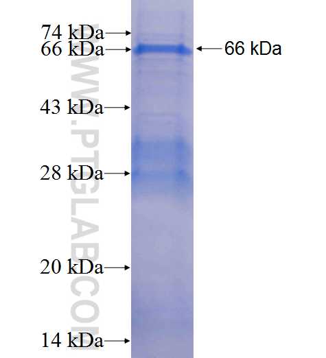 CCNE2 fusion protein Ag2532 SDS-PAGE