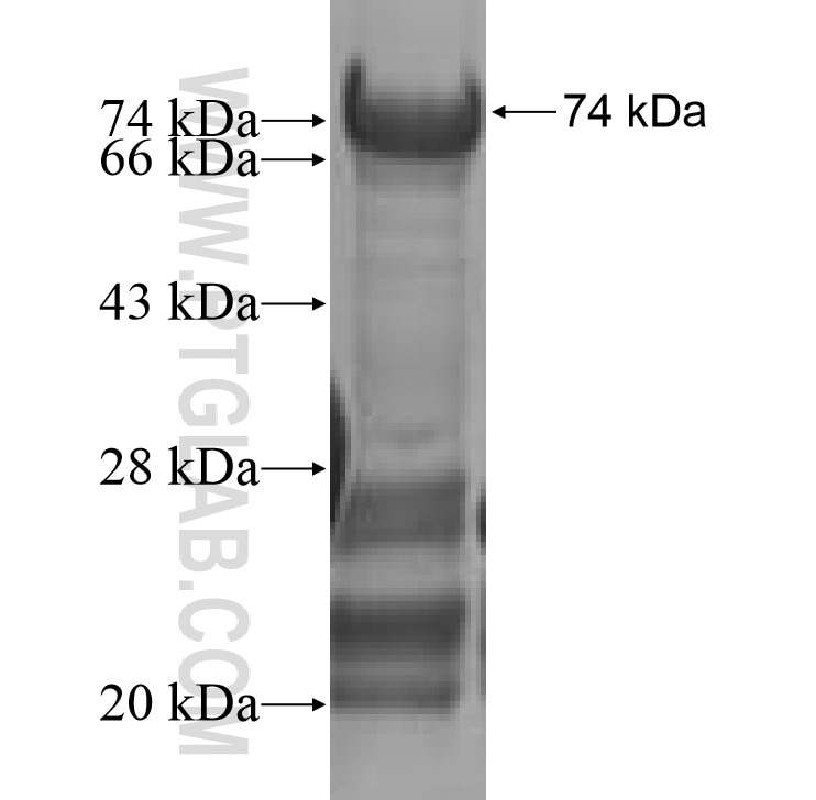 CCNF fusion protein Ag9207 SDS-PAGE