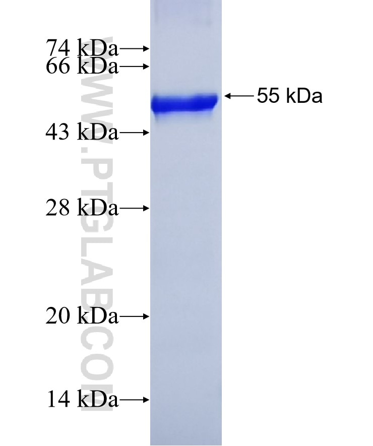 CCNF fusion protein Ag9322 SDS-PAGE