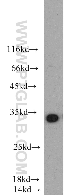 Cyclin G Polyclonal antibody