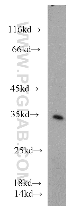Western Blot (WB) analysis of mouse liver tissue using Cyclin G Polyclonal antibody (10897-1-AP)