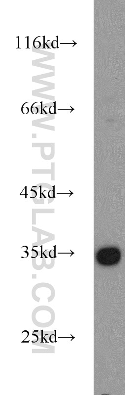 WB analysis of mouse ovary using 10897-1-AP