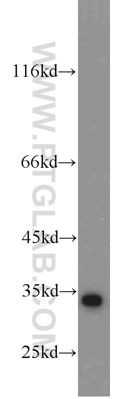 Western Blot (WB) analysis of HeLa cells using Cyclin G Polyclonal antibody (10897-1-AP)