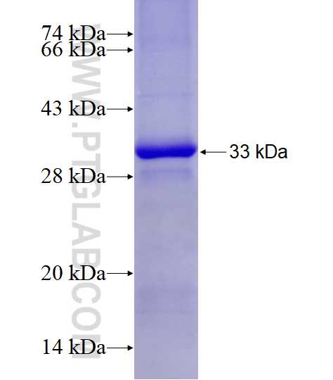 CCNG1 fusion protein Ag21300 SDS-PAGE