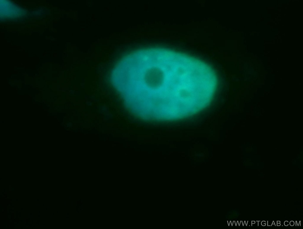 Immunofluorescence (IF) / fluorescent staining of SH-SY5Y cells using Cyclin H Polyclonal antibody (10718-1-AP)