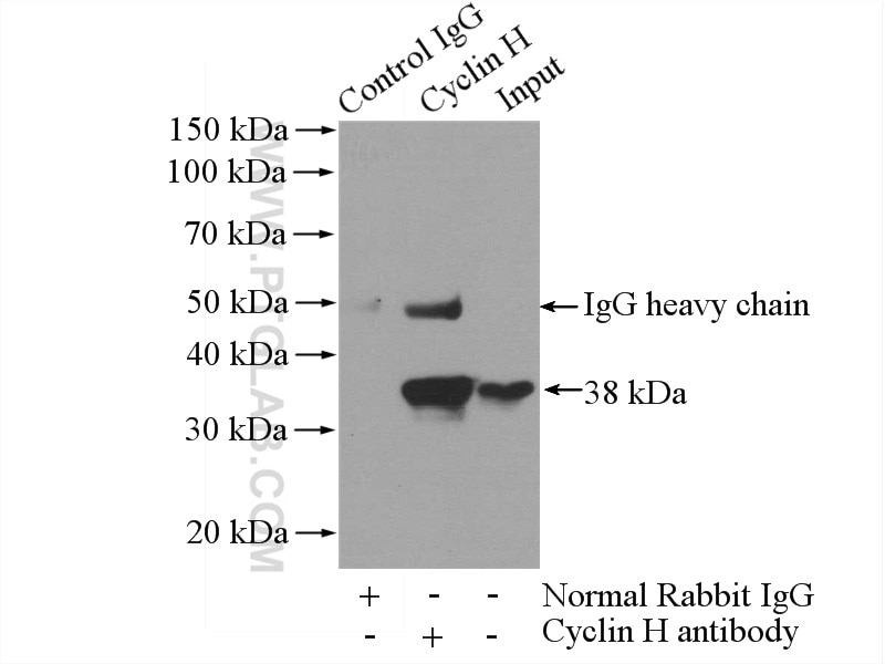 Immunoprecipitation (IP) experiment of HeLa cells using Cyclin H Polyclonal antibody (10718-1-AP)
