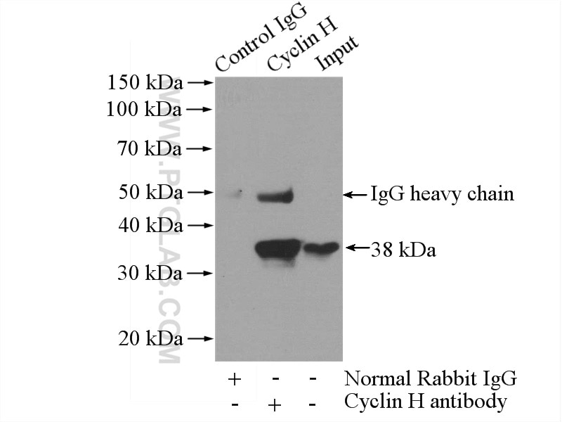 IP experiment of HeLa using 10718-1-AP