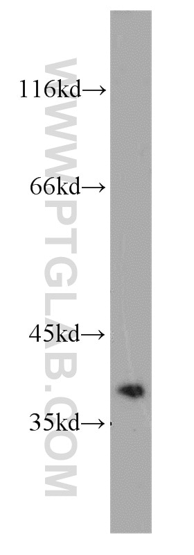 Western Blot (WB) analysis of A375 cells using Cyclin H Polyclonal antibody (10718-1-AP)