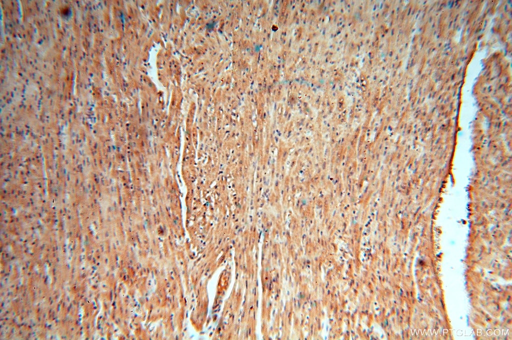 IHC staining of human heart using 16357-1-AP