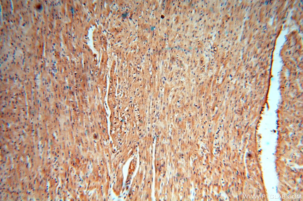 Immunohistochemistry (IHC) staining of human heart tissue using cyclin I Polyclonal antibody (16357-1-AP)