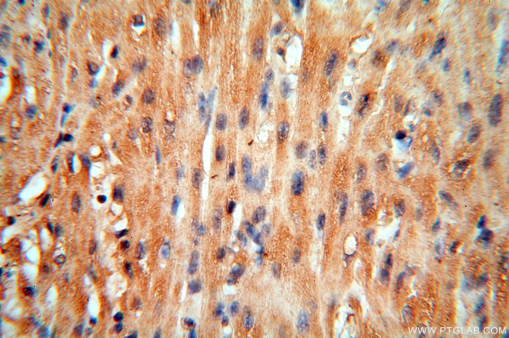 Immunohistochemistry (IHC) staining of human heart tissue using cyclin I Polyclonal antibody (16357-1-AP)