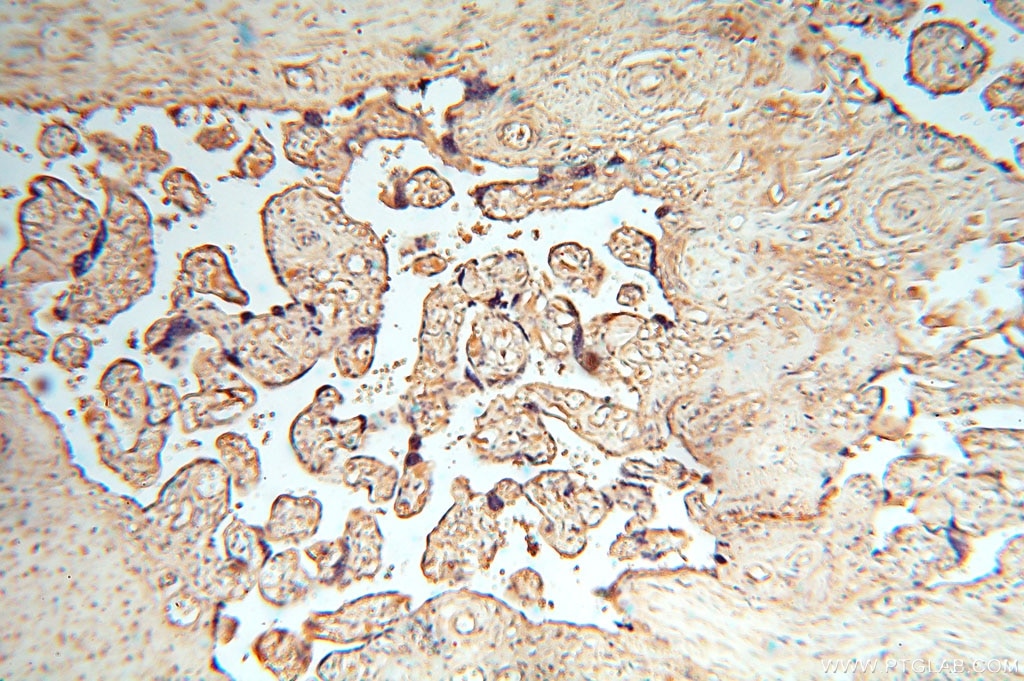 Immunohistochemistry (IHC) staining of human placenta tissue using cyclin I Polyclonal antibody (16357-1-AP)