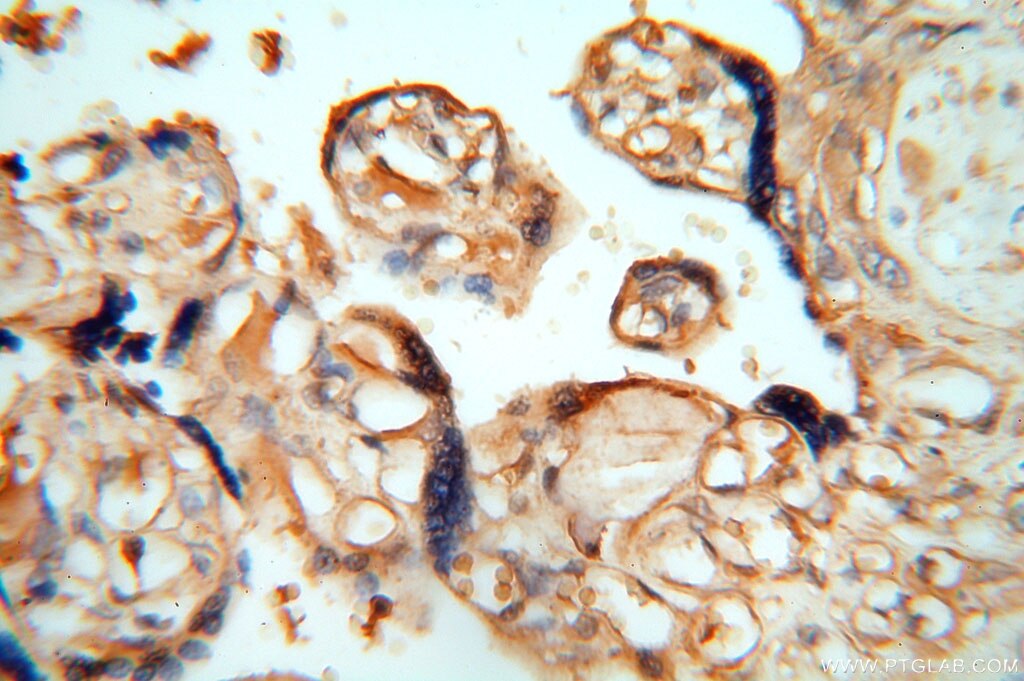 IHC staining of human placenta using 16357-1-AP