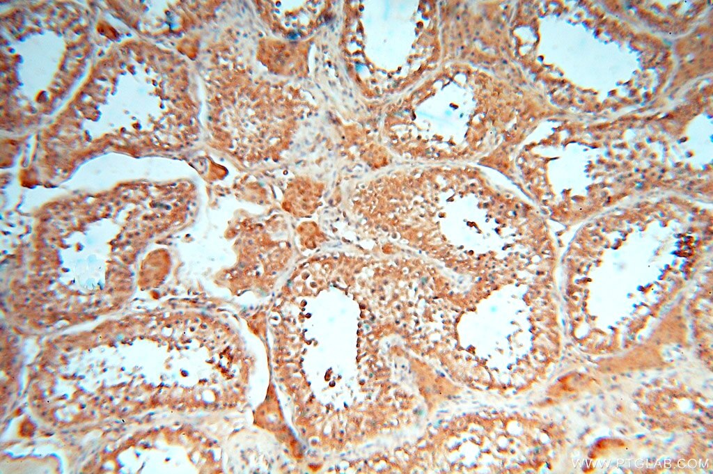 Immunohistochemistry (IHC) staining of human testis tissue using cyclin I Polyclonal antibody (16357-1-AP)