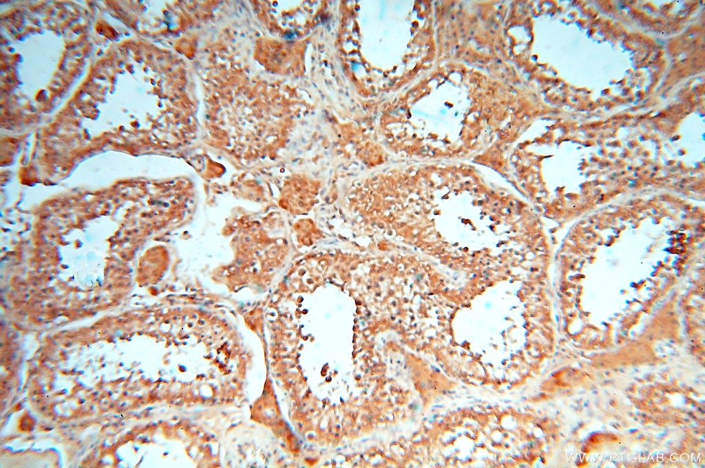 IHC staining of human testis using 16357-1-AP