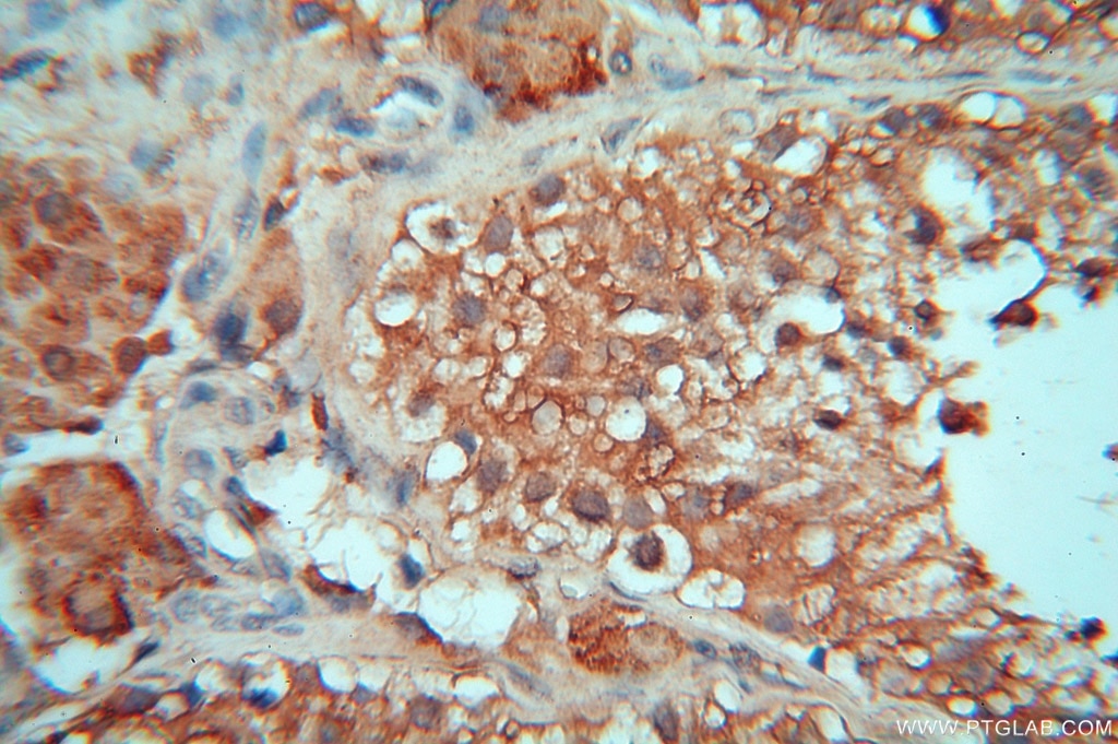 Immunohistochemistry (IHC) staining of human testis tissue using cyclin I Polyclonal antibody (16357-1-AP)