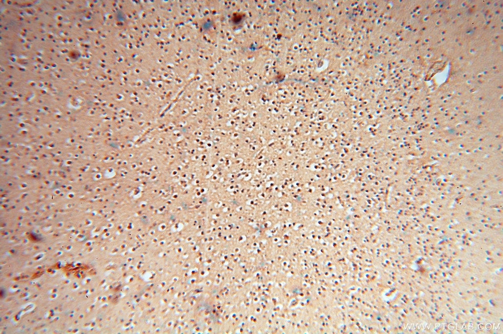 Immunohistochemistry (IHC) staining of human brain tissue using cyclin I Polyclonal antibody (16357-1-AP)