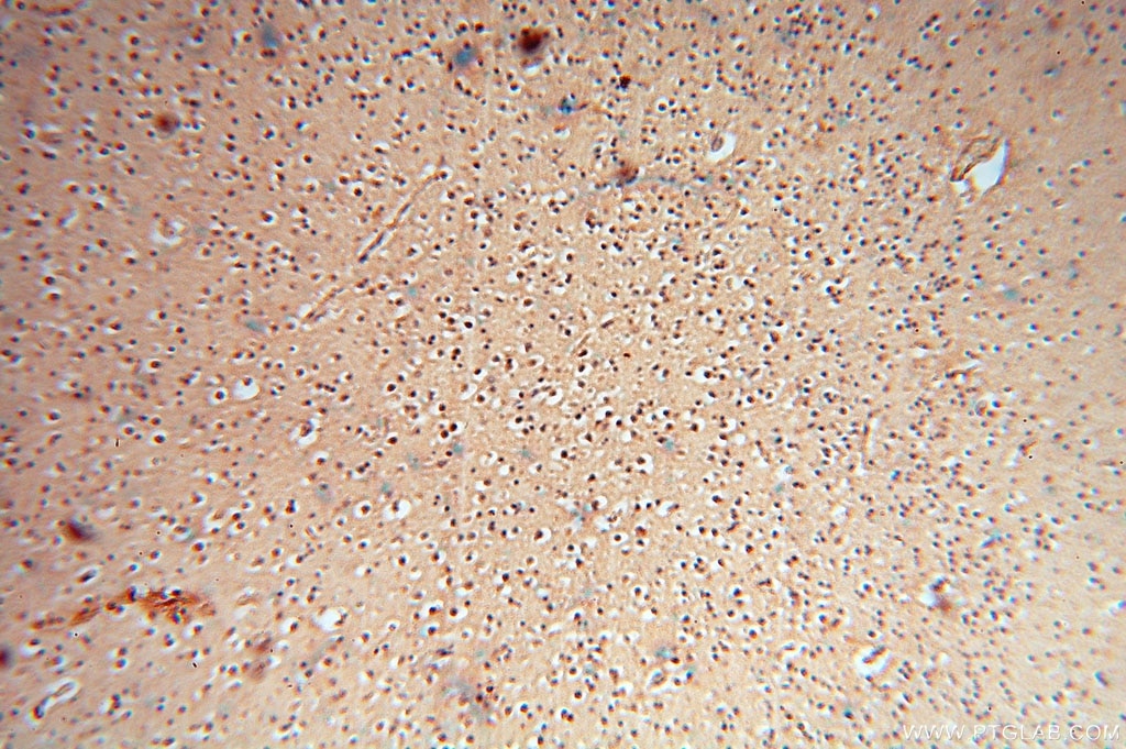 Immunohistochemistry (IHC) staining of human brain tissue using cyclin I Polyclonal antibody (16357-1-AP)