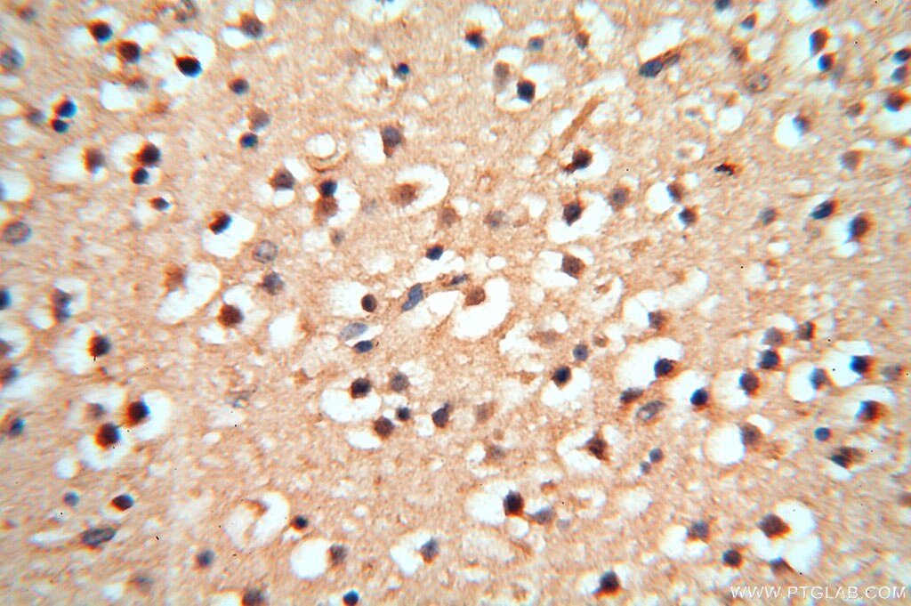 Immunohistochemistry (IHC) staining of human brain tissue using cyclin I Polyclonal antibody (16357-1-AP)