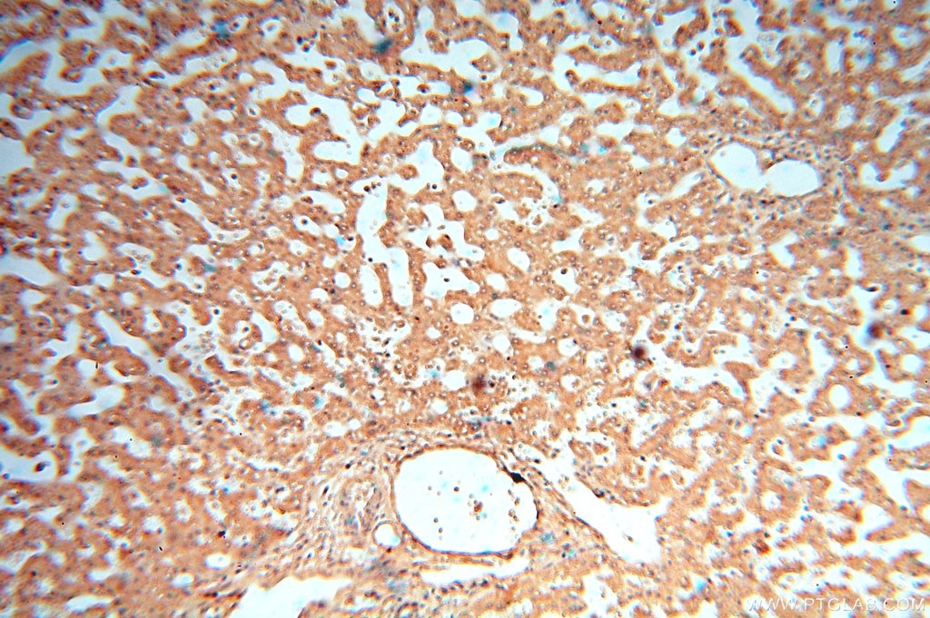 Immunohistochemistry (IHC) staining of human liver tissue using cyclin I Polyclonal antibody (16357-1-AP)