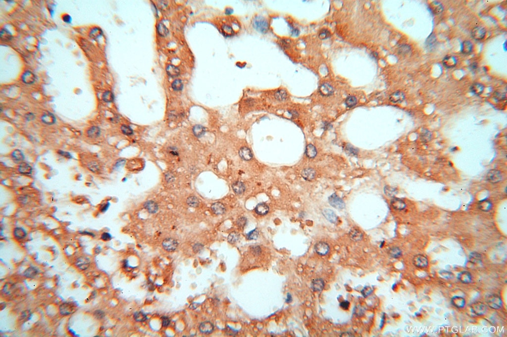 Immunohistochemistry (IHC) staining of human liver tissue using cyclin I Polyclonal antibody (16357-1-AP)