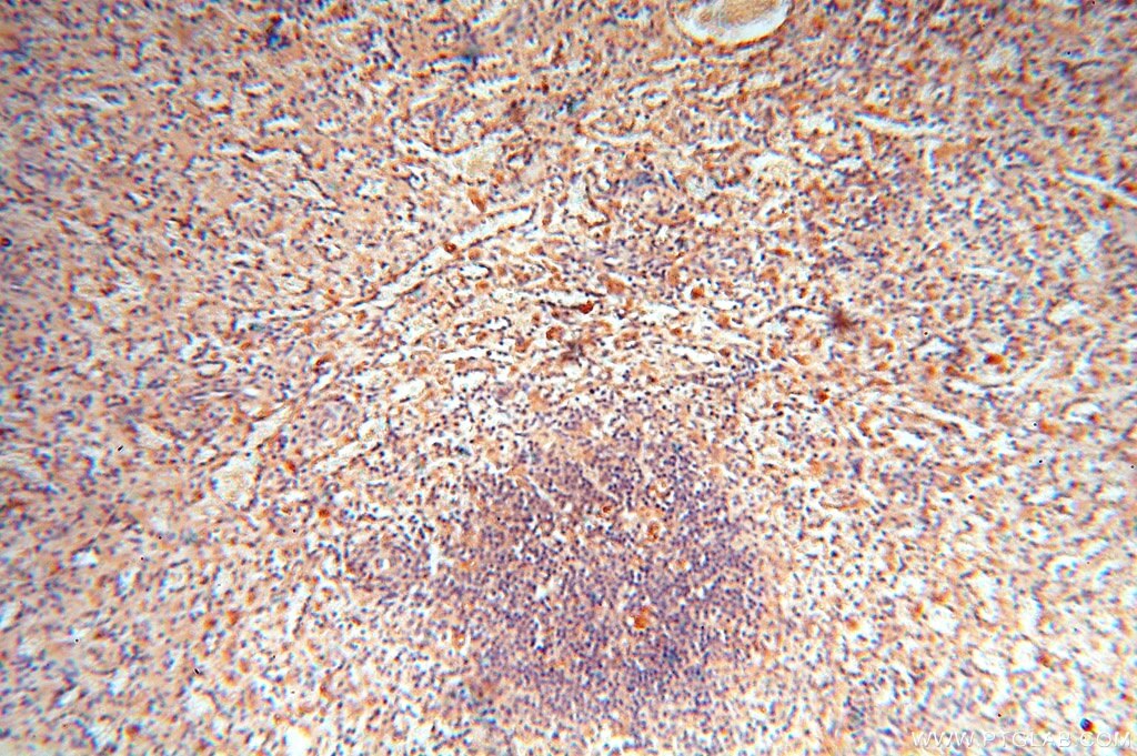Immunohistochemistry (IHC) staining of human spleen tissue using cyclin I Polyclonal antibody (16357-1-AP)