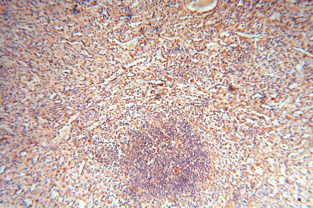 IHC staining of human spleen using 16357-1-AP