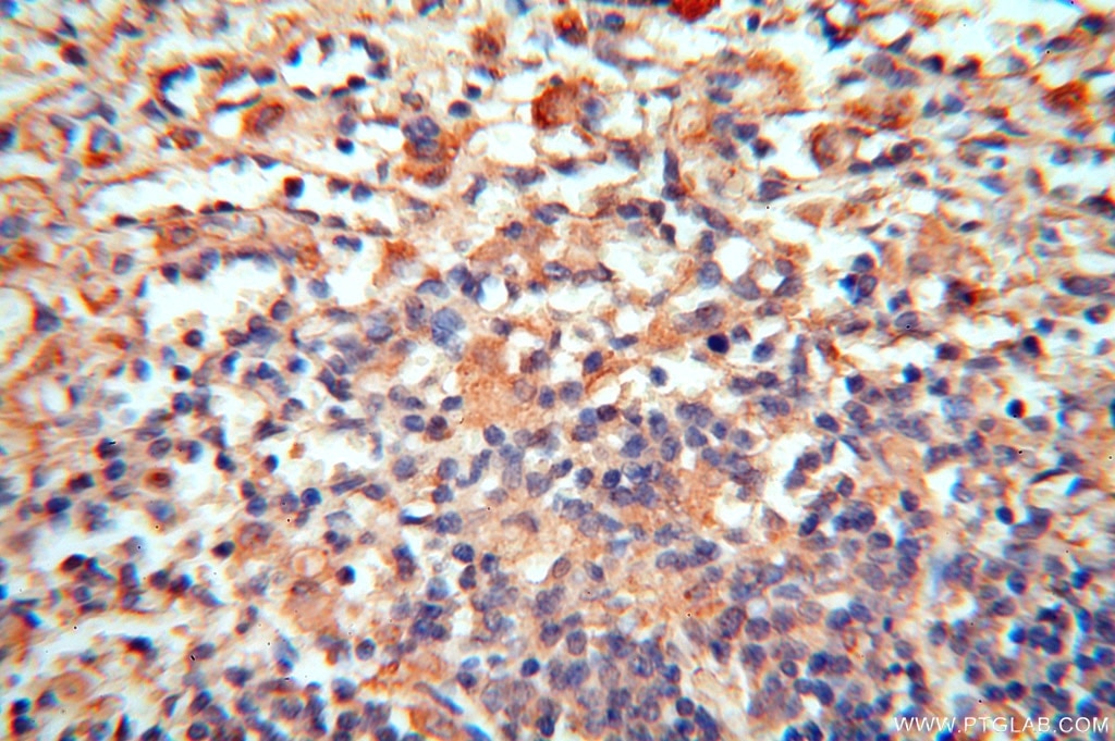 Immunohistochemistry (IHC) staining of human spleen tissue using cyclin I Polyclonal antibody (16357-1-AP)